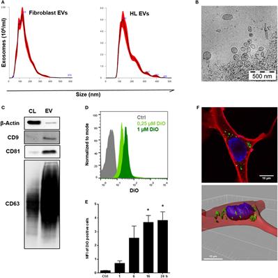 Hodgkin Lymphoma-Derived Extracellular Vesicles Change the Secretome of Fibroblasts Toward a CAF Phenotype